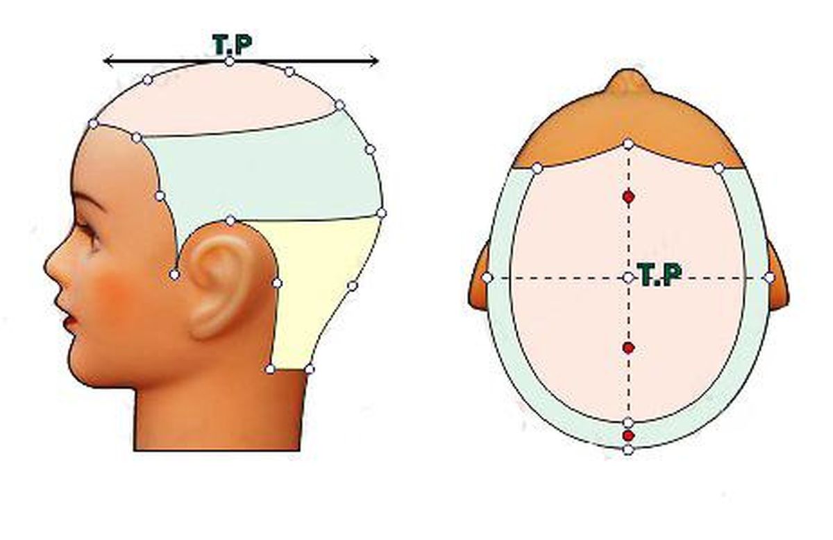 điểm thượng trên đầu